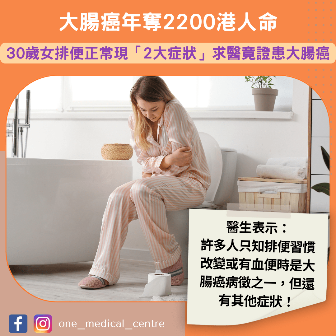 【大腸癌年奪2200港人命　30歲女排便正常現「2大症狀」　求醫竟證患大腸癌】